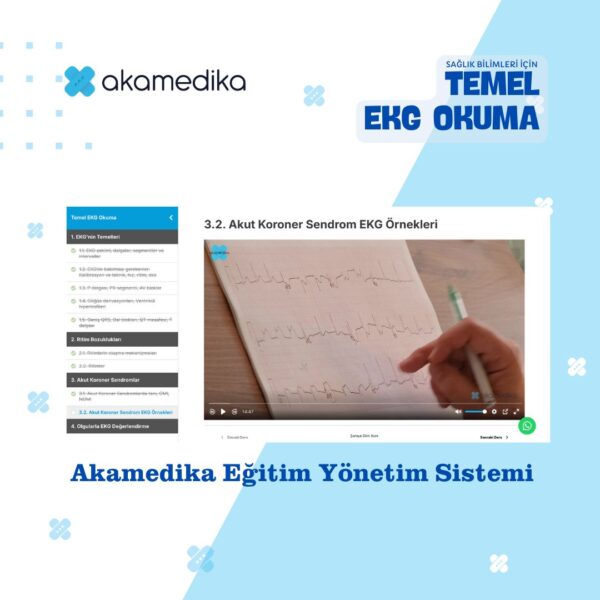 Temel EKG Okuma - Görsel 3