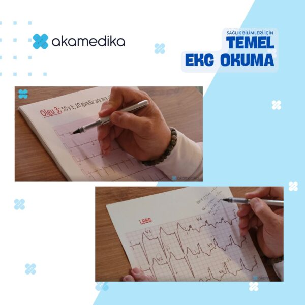 Temel EKG Okuma - Görsel 4